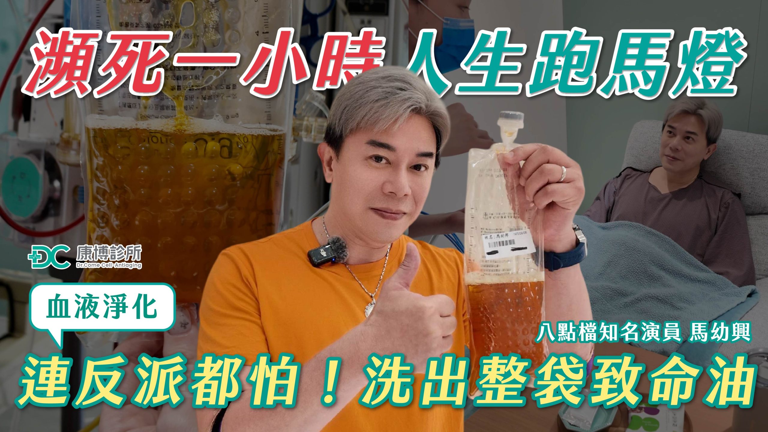 男星馬幼興突發心絞痛！血液淨化找回健康，預防高血脂症狀與三高危機